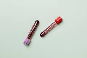 Smear testi